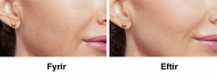 product-sub-image