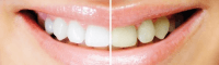 product-sub-image