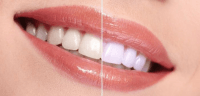 product-sub-image